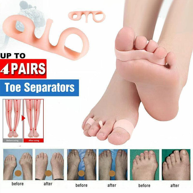 Bunion Corrector Toe Straightener Separators Silicone Gel Elastic Spacers New AU - Aimall