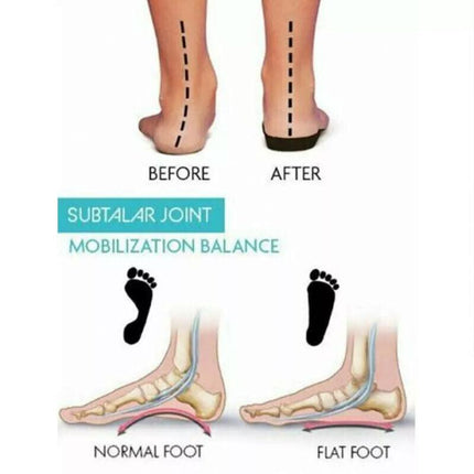 Bunion Corrector Toe Straightener Separators Silicone Gel Elastic Spacers New AU - Aimall