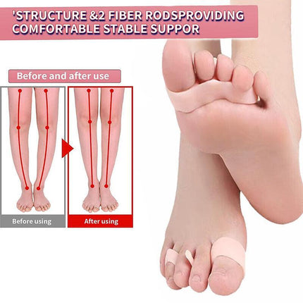 Bunion Corrector Toe Straightener Separators Silicone Gel Elastic Spacers New AU - Aimall
