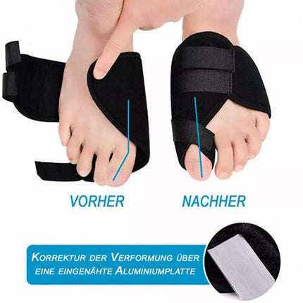 Unisex Big Bunion Straightener Toe Pain Relief Orthotics Hallux Valgus Corrector - Aimall