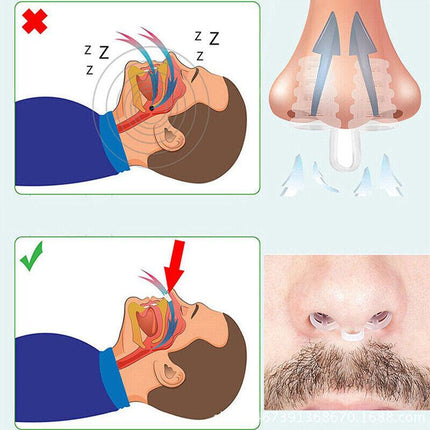 Silicone Anti Snore Nasal Dilators Stop Snoring Nose Clip Sleep Apnea Aid Device - Aimall