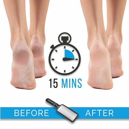 Stainless Steel Foot File Scraper Grater Pedicure Rasp Callus Remover Tool AU - Aimall