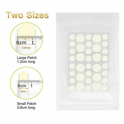 36 Pcs Acne Pimple Plasters Patch Removal Blemish Control Skin Facial Care Spot - Aimall