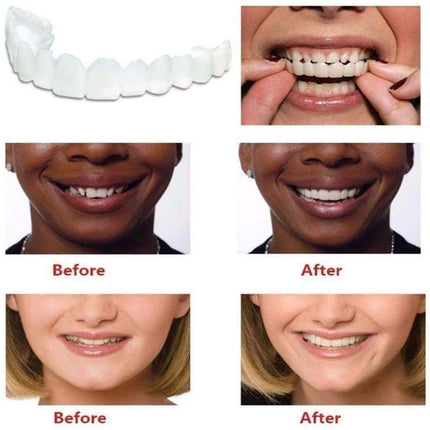 Snap On Bottom /Upper Lower False Teeth Dental Veneers Dentures Fake Tooth Smile - Aimall