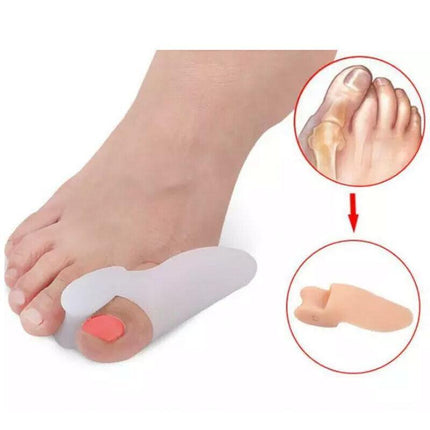 2xSilicone Gel Bunion Protector Toe Straightener Separator Alignment Pain Relief - Aimall