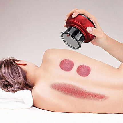 Electric Intelligent Vacuum Cupping Therapy Red Light Heating Body Slimming - Aimall
