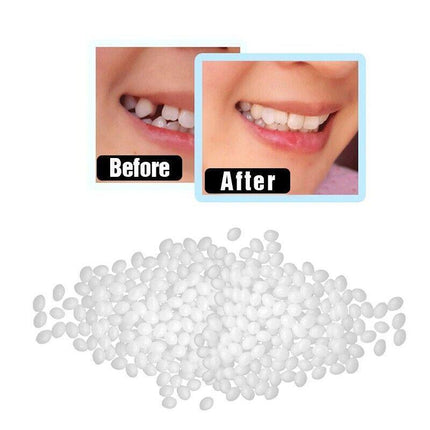 Temporary Tooth Repair Kit Teeth Gaps False Teeth Solid Glue Denture Adhesive - Aimall