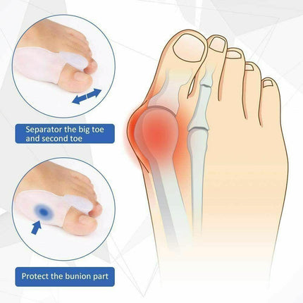 2xSilicone Gel Bunion Protector Toe Straightener Separator Alignment Pain Relief - Aimall