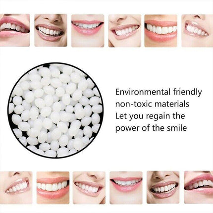 Temporary Tooth Repair Kit Teeth Gaps False Teeth Solid Glue Denture Adhesive - Aimall