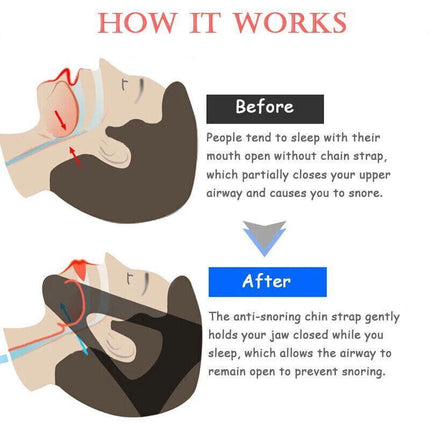 New Stop Snoring Chin Strap Anti Snore Sleep Apnea Belt Device Solutions Jaw OZ - Aimall