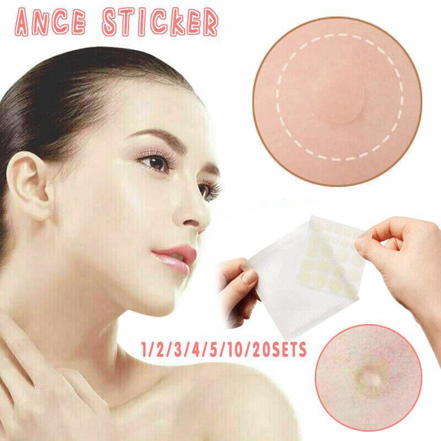 Cosrx Acne Pimple Master Patch 24 Patches Blemish Control Genuine New Sealed AU - Aimall