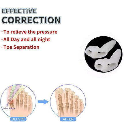 2xSilicone Gel Bunion Protector Toe Straightener Separator Alignment Pain Relief - Aimall